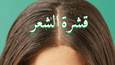 صورة طريقة علاج قشرة الشعر